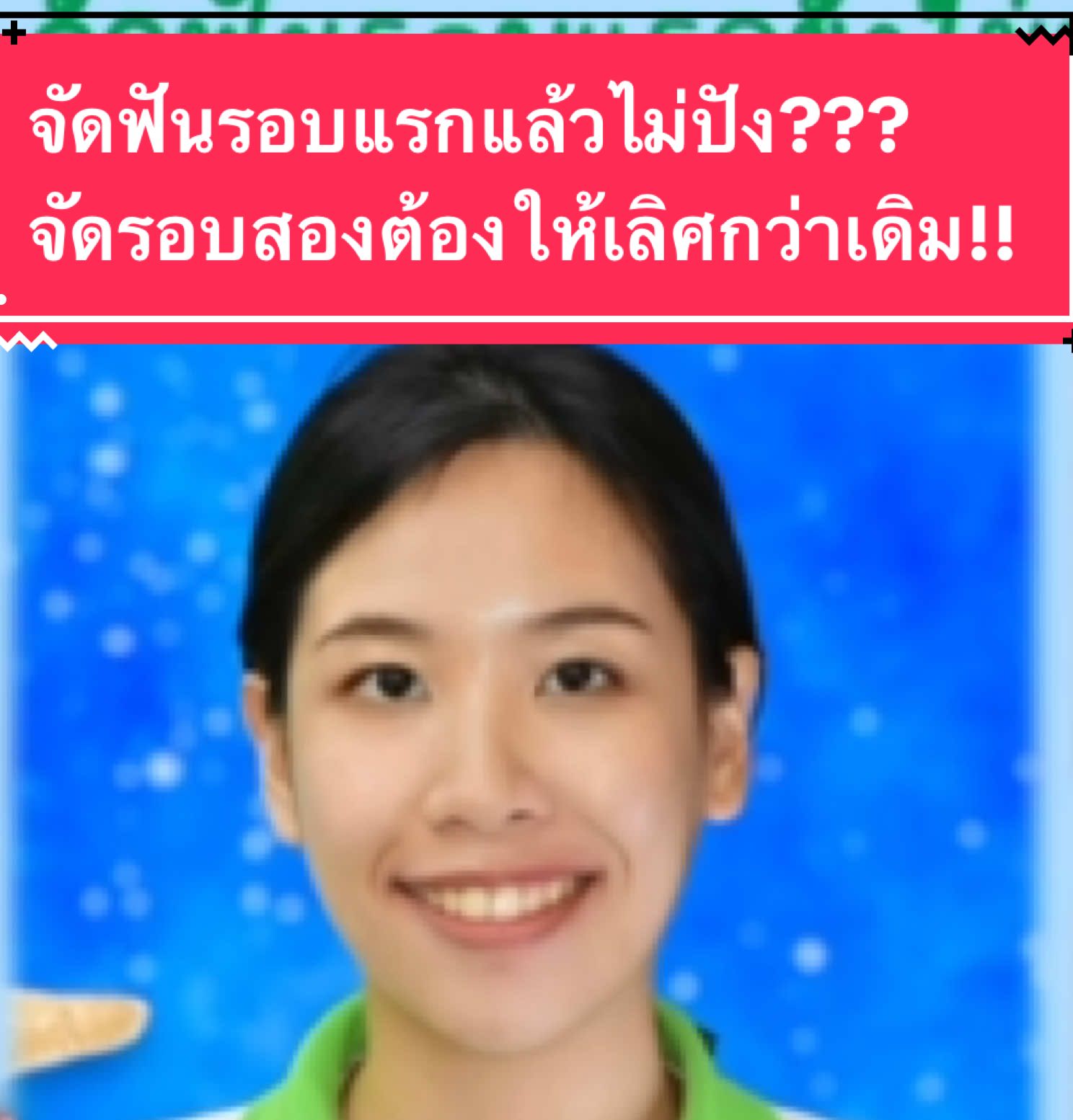 #จัดฟันรอบสอง #จัดฟันเปลี่ยนชีวิต #จัดฟันปราจีนบุรี #จัดฟันนครนายก จัดฟันรอบแรกถ้ามีปัญหาอย่าท้อ จัดฟันรอบสองแก้ไขให้ดีขึ้นได้นะครับ @คลินิกทันตแพทย์วิรัชปราจีนบุรี 