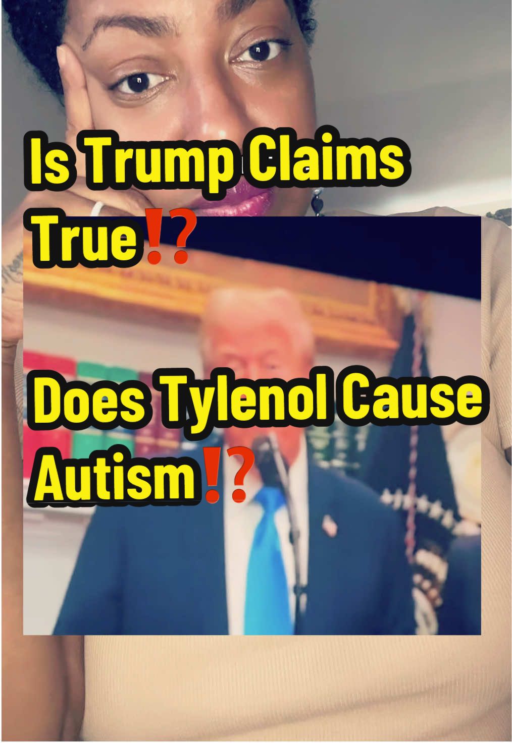 🚨 Did Trump Blame Moms Tylenol Use on Their Babies Autism⁉️😤🚨  Today’s headline sounded like a parody: Tylenol blamed for autism, and the Amish as the ‘proof.’ 🥴 But science doesn’t agree. A massive study found no causal link between Tylenol in pregnancy and autism, and yes‼️ autism exists in Amish communities too. Moms deserve support, not blame. 🧠🕊️ Let’s spread facts‼️  #blacknews #tylenol #autismawareness #autismmoms #donaldtrump 