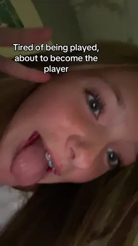 Tired of it #foryoupage #blonde #braces #relatable #player 
