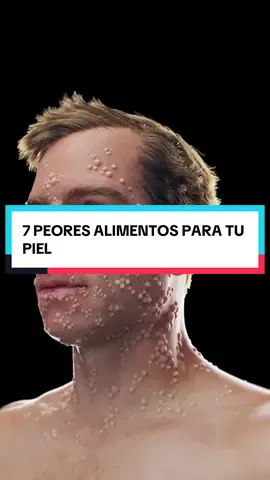🚫 7 peores alimentos para tu piel: 1️⃣ Leche descremada → desajusta hormonas, más acné. 2️⃣ Aceites de semillas → ricos en omega-6, súper inflamatorios. 3️⃣ Pan (blanco o integral) → se convierte en azúcar → arrugas por glicación. 4️⃣ Edulcorantes artificiales → arruinan tu microbioma intestinal y cutáneo. 5️⃣ Carne procesada → químicos, nitratos y maltodextrina dañan la piel. 6️⃣ Proteína de soya → ultraprocesada, con solventes y proinflamatoria. 7️⃣ Jugo de fruta → azúcar líquida que acelera el envejecimiento. 👉 Cuida tu piel desde adentro, no solo con cremas. Desde dónde nos ves 🌍, déjalo en los comentarios y síguenos para optimizar tu salud. #piel #salud #fyp 