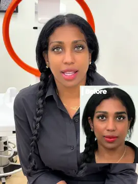 ¡Una experiencia increíble desde el primer día! 💚 Cambiar el color de mis ojos con el equipo de KERATO y el Dr. Movshovich fue una decisión que me cambió la vida. El trato fue profesional, cercano y muy humano. Me sentí segura en cada paso, y el resultado... ¡es simplemente hermoso! Gracias por hacer mi sueño realidad. ✨👁️ 📞+1 (866) 426-5671 💌info@kerato.com 🌐www.kerato.com 🗽 160 E 56 street, NEW YORK 🌴 860 NW 42 ave MIAMI FL