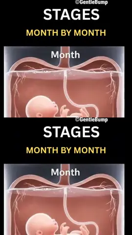 #ivf #fyp #ttc #infertility #baby 