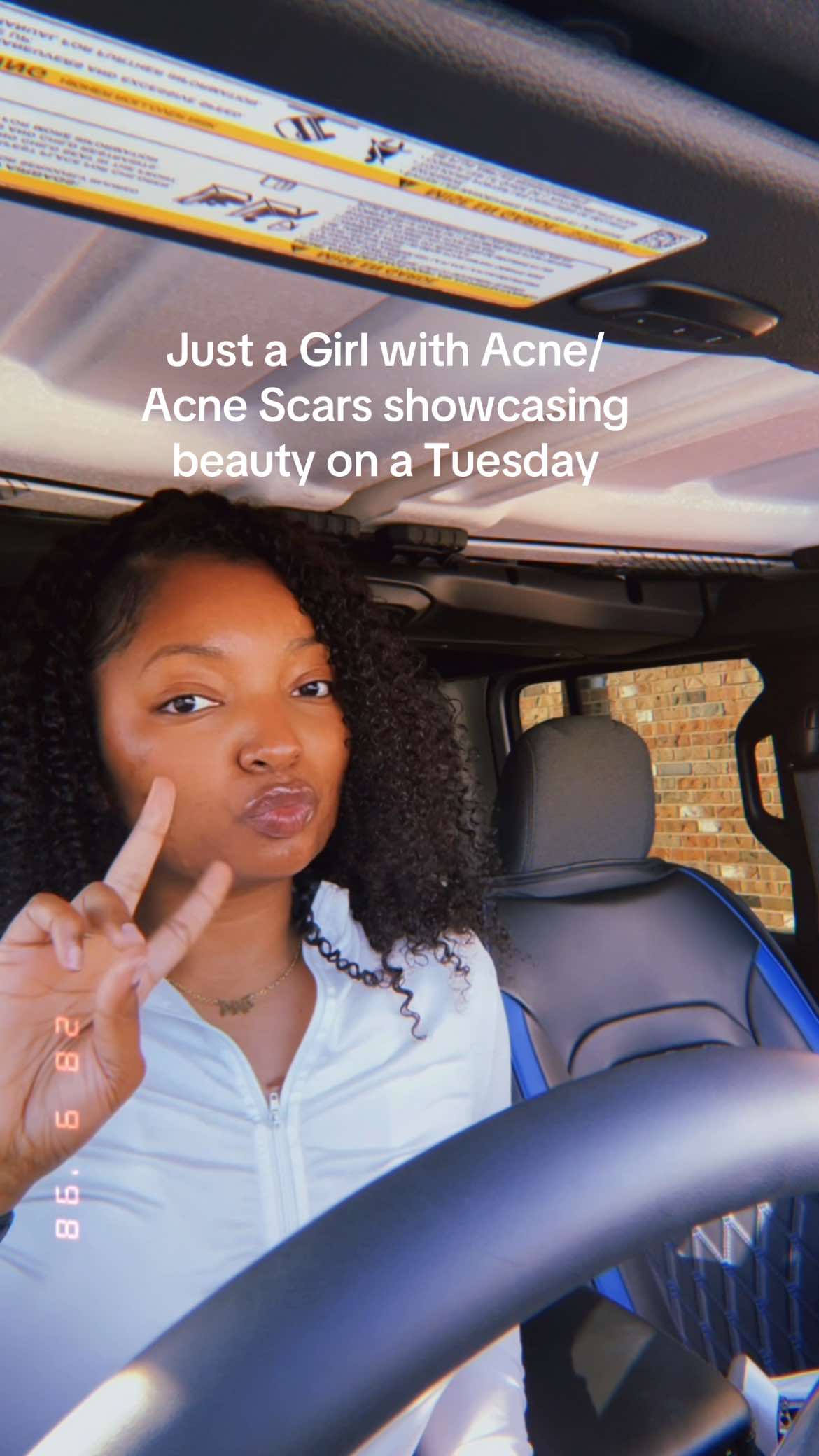 I’m a woman with Acne who chooses daily to feel beautiful 💕. #acne #blackgirls #acnescars #feelingbeautiful #foryoupagе 