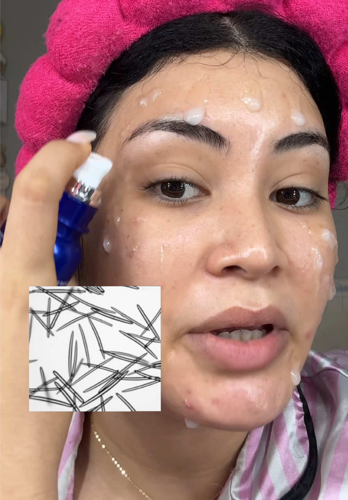 MediCube One Day Exosome Shot 2000 Que te eliminará todos esos poros y puntos negros dilatados con MediCube 🩵✨ @medicube global #medicube #exosomeshot #medicubeskincare #liquidmicroneedling #kbeauty 