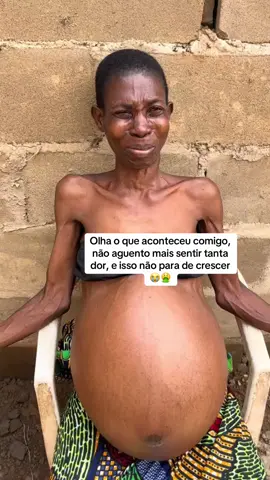Olha o que aconteceu comigo, os médicos diziam ser gravidez, mais minha barriga não parava mais de crescer 😭🙏🏻🤮 #tumor #gravideznaoplanejada #doenca #cancer 