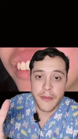 CEPÍLLENSE LOS DIENTES!! #odonto #odontologia #fyp #parati #gingivitis 