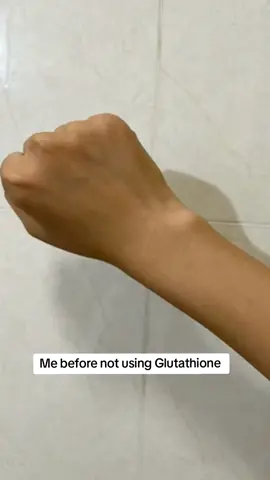 Me After using this effectibe Glutathione set #madeinnepal🇳🇵 #glutalotion #skincareproductsbyzuwacosmetic #zuwacosmetics #goviral #fyp 