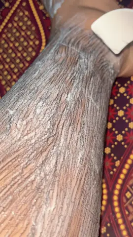 Maapin perempuan berbulu ini ya #bulukaki #hairremove #fyp 