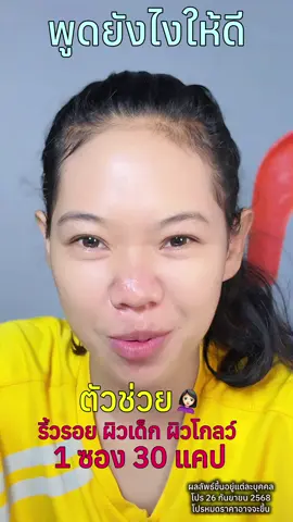 #กลอรี่คอลลาเจน #กลอรี่คอลลาเจนแม็กซ์โดส #กลอรี่คอลลาเจน1maxdoseท่ากับ1drip #กลอรี่คอลลาเจนเกรดพรีเมี่ยมเข้มข้น30เท่า #glorycollagen
