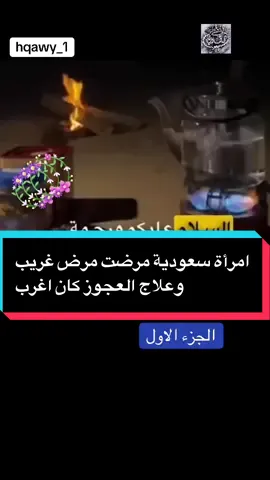 امرأة سعودية مرضت مرض غريب وعلاج العجوز كان اغرب#هقاويہ #هقاوي #hqawy_1 #dagt_anfasy #الشعب_الصيني_ماله_حل😂😂 