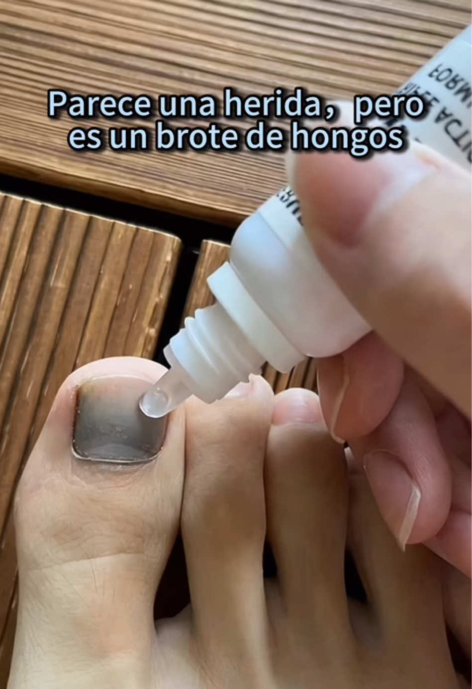 si tú también tienes esta situación , i puedes probar este método#nailcare#gainknowledge #toenails #tiktokmademebuyit #foryoupage 