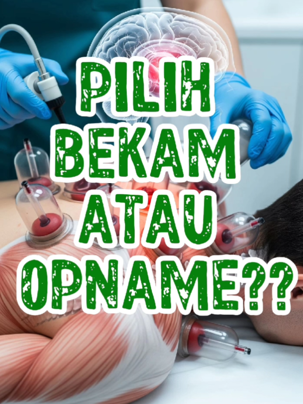 Mencegah lebih baik daripada mengobati #bekampanggilan #bekamjabodetabek #fyp #bekamdepok #bekamjakarta 