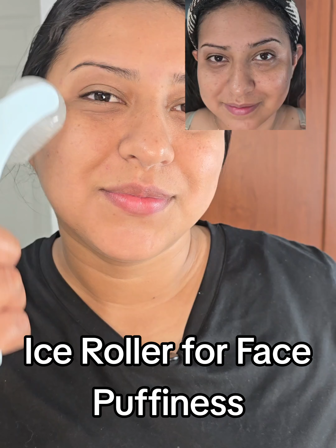 Empezar con la terapia de hielo es lo mejor que hice🥹🥰 #iceroller #icerollerforface #Terapiadehielo #hieloterapia #Skincare 
