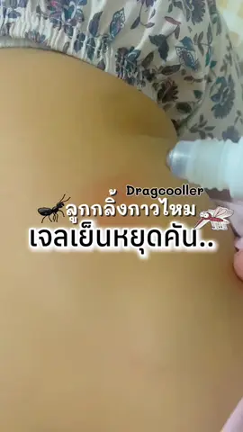 ตัวช่วยแม่เริสๆ#ลูกกลิ้งกาวไหม #ลูกกลิ้งกาวไหมdragkooler #ลดคันหลังยุงกัด #ตัวช่วยคุณแม่ 