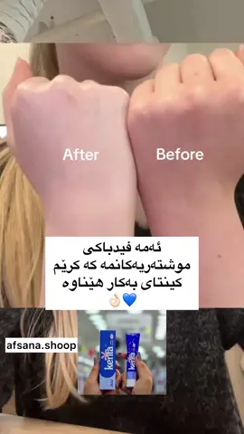 کرێمی کێنتا زۆرترین داواکراو  سوودەکانی کرێمی کینتا 💗🍃؛ 🌸 - کرێمی سپیکردنەوەی کرێمی کێنتا بۆ کاڵکردنەوەی😋 ناوچە تاریکەکانی😔 لەش بەکاردێت و لەم مەبەستەدا زۆر کاریگەرە. 🌸 بۆ کاڵکردنەوەی ناوچە👍🏻 تاریکەکانی جەستە وەک ناوچەی ئانیشک و ئەژنۆ😋 بەکار دەهێنرێت. 🌸 کرێمی کێنتا بۆ سپیکردنەوەی ناوچە هەستیارەکانی🩷 لەش بەکاردێت لەماوەی مانگێک یان کەمتر سوودی تەواو دەبینی👍🏻✅ شێوازی بەکارهێنان؛ سەرەتا  شوێنی مەبەست بە ئاوی شلەتێن بشۆی دوای ئەوەی بەجوان وشک بوویەوە شوێنەکە کرێمەکەی لێبدەو بەشێوەی بازنەی مەساجی پێبکە، واباشترە  شوێنەکە بە نایلۆن بپێچرێت بۆ ئەوەی سوودی تەواو ببینیت✅ واباشترە شەوان بەکاردبێ و نابێ لەکاتی بە کارهێنانی خۆر لێت بدات   بۆخانمانی دووگیان نابێ⚠️ #fiiiiiiiiiiiiiiiiiiiiiiiiiiiiiiiiiiiiip #tiktok #foryou #accccccccccccccccccccccccccccccc #explorepage #actives? #afsana #viral #گرینگیدان_بە_پێست #foryoupage 