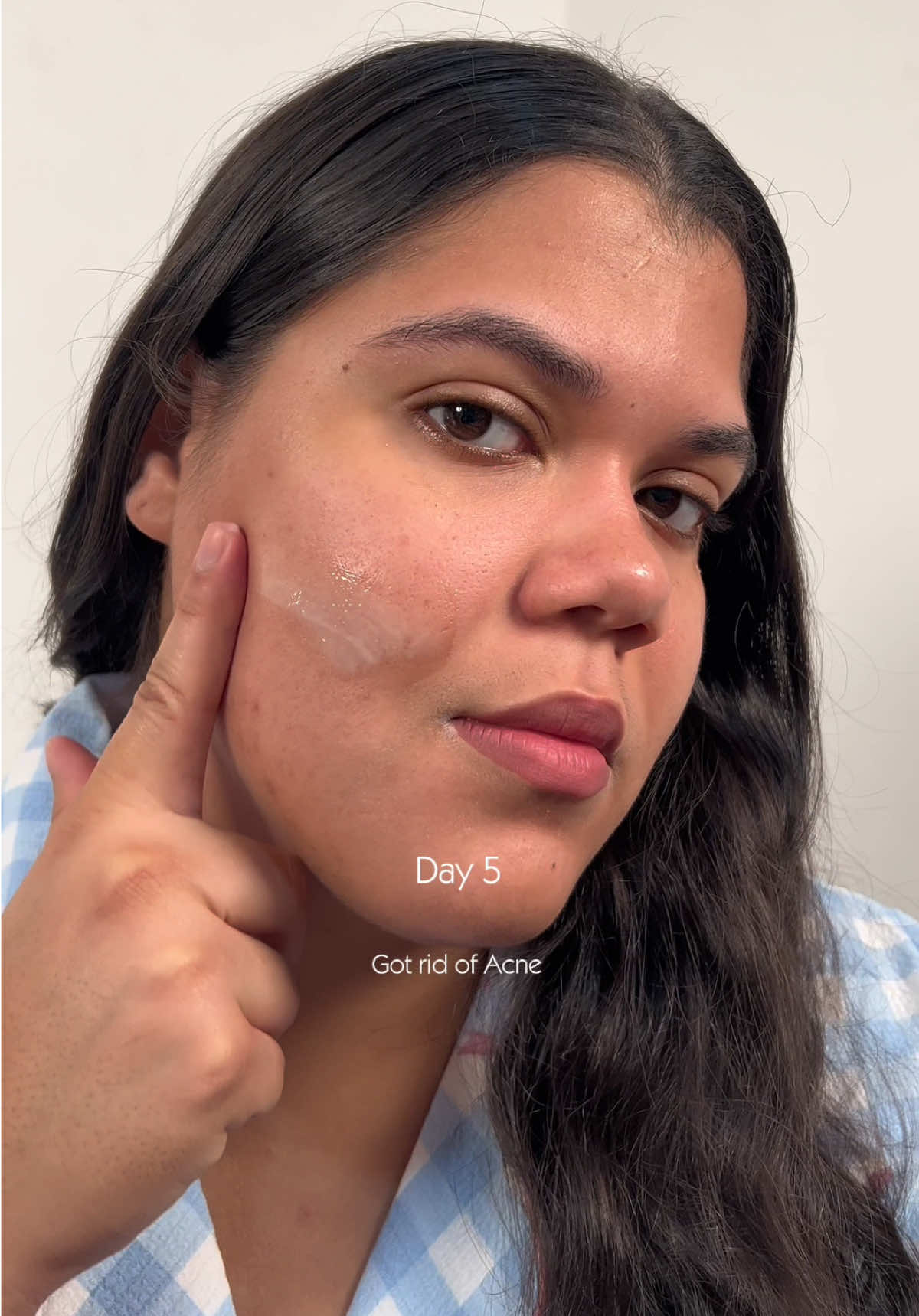 @PURITO SEOUL #Purito #PanthenolCream #AcneTreatment #RealPostAcneCream #RealPostAcneCreamChallenge