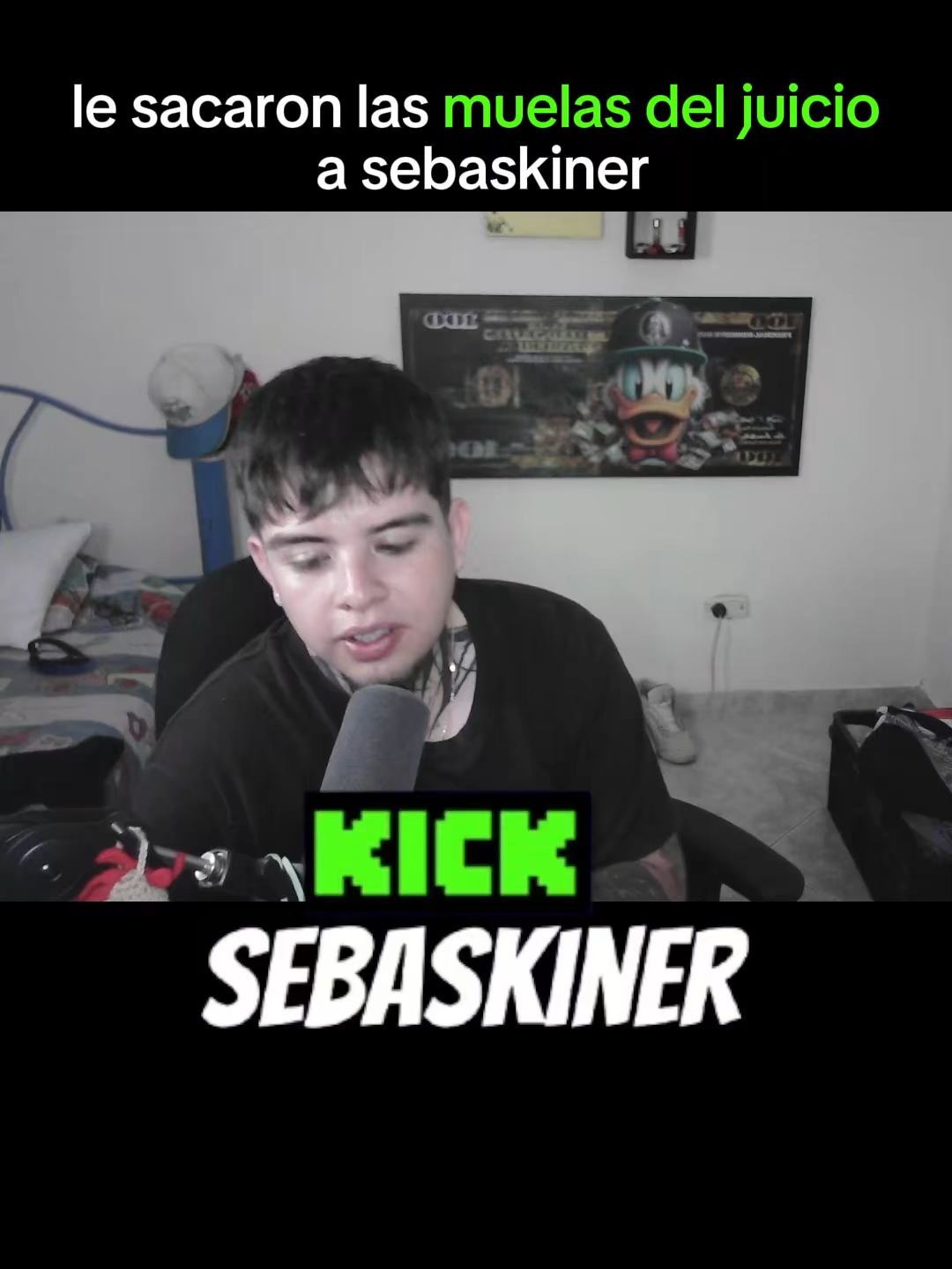 me sacaron las muelas del juicio  #sebaskiner #kick #mueladeljuicio