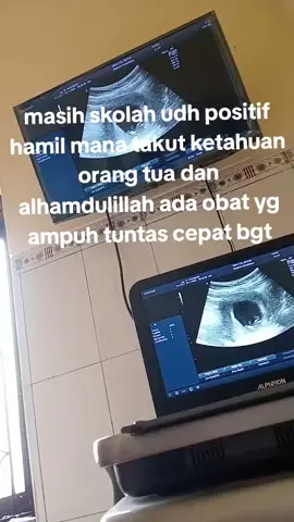 #paketmiso#misopeluntur#telatdatangbulan#positifhamil#antikuret