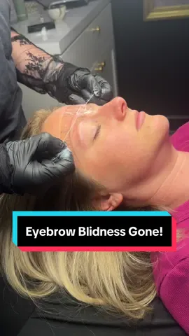 Chelsey did some vodo magic y’all! I’m eyebrow blind no more! I am in love with the outcome. I’m so thankful for all the encouragement I got from this small corner of the internet ❤️ check out my girl Chelsey! If you’re in the Athens, TN area, def go see her! @PMU | SKINCARE | MAKEUP #eyebrowblindness #eyebrows #MomsofTikTok #sahm #makeover 