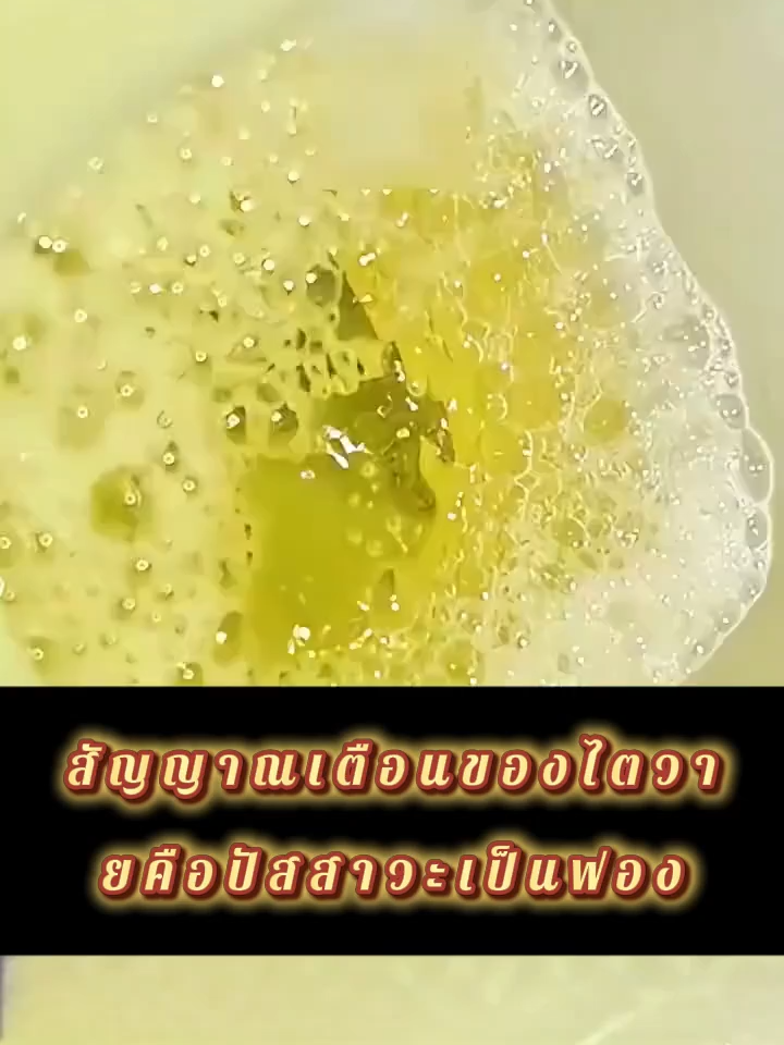9.25 MY DBP✅【Triple Action in One, Eksklusif untuk rakyat Malaysia!】✅ Dandelion + Hovenia Dulcis + Protein Cacing Tanah → Perlindungan Hati ✚ Melegakan Hangover ✚ Pembersihan Salur Darah 🍺Terlalu banyak penglibatan sosial? Penat berjaga lewat? Bergelut dengan kolesterol tinggi, gula darah tinggi dan tekanan darah tinggi? Yang ini mempunyai semuanya!-636236