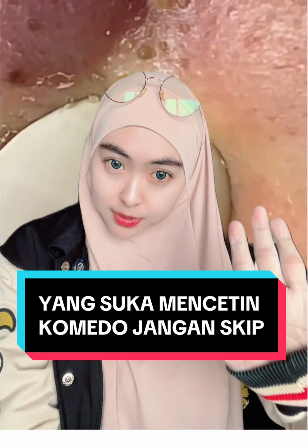 Tips biar komedo hempas tanpa dramaa🔥 Btw siapa yang masih suka mencetin kayak vt di atas?🤏