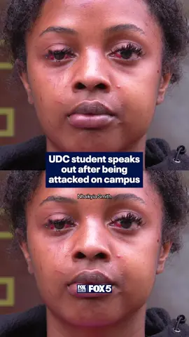 A University of the District of Columbia student is speaking out after reporting a violent attack on campus early Tuesday morning. Nhaikyia Smith, a student-athlete, told police she was assaulted while walking to practice. Click the link in our bio for more details.