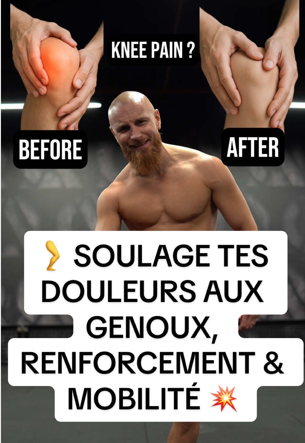 🦵 SOULAGE TES DOULEURS AUX GENOUX, RENFORCEMENT & MOBILITÉ 💥 ENREGISTRE • LIKE • COMMENTE • PARTAGE Objectif ⬇️ Apaiser les douleurs aux genoux, renforcer les muscles stabilisateurs et améliorer la mobilité pour protéger tes articulations. Séance complète ⬇️ • 6 exercices ciblés • 4 séries par exercice • 30 secondes d’effort par série • 20 secondes de récupération entre chaque série • Concentre-toi sur la technique, la respiration et la fluidité des mouvements pour éviter toute contrainte inutile Tu bosses déjà la mobilité et le renfo pour protéger tes genoux ? 👇🏼 ⸻ #mericcoach #genoux #douleursgenoux #renforcementgenoux #mobilitegenoux                        