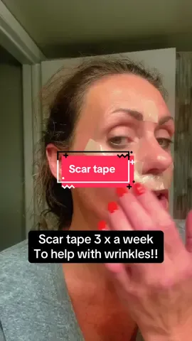 ✨ Wake up to smoother, younger-looking skin 🌙💖 Scar tape works overnight to lock in hydration, flatten fine lines, and reduce sleep wrinkles — all while you rest! A simple, reusable, non-invasive anti-aging hack for women 30+. #ScarTape #WrinklePatches #AntiAgingTips #OvernightBeauty #GlowingSkin