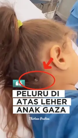 Anak yg bernama Lana Al-Basous secara ajaib selamat setelah ditembak di kepala oleh peluru yang ditembakkan drone israel Peluru itu bersarang di antara tengkorak dan kulit kepalanya tanpa menembus . Alhamdutilah atas kuasa Allan keajaiban ini terjadi Namun sayangnya kasus selamat ini sangat jarang terjadi dan banyak anak-anak di Gaza menjadi korban serangan penjajah israel Bahkan saat mereka mengantri dan menunggu untuk mendapatkan bantuan dari PBB mereka dihujani tembakan oleh pasukan penjajah israel . FREE PALESTINE🇵🇸🇮🇩🍉 #freepalestine🇵🇸❤️ #freepalestine🇵🇸 #freepalestine #palestine #palestine🇵🇸 