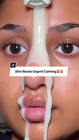 URGENT CALMING TREATMENT AD🚨‼️🚨‼️@ongredients_official #ongredients #kbeauty #skinbarriercalminglotion #barriercare #glowskinroutine