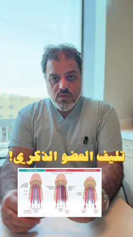الانتصاب المستمر والمؤلم عند مرضى التكسر المنجلي حالة طارئة 🚨 لازم تروح الطوارئ فورًا، لأن التأخير ممكن يسبب تليف في الذكر ويأثر على الخصوبة  كثير من المرضى يخجلون يراجعون المستشفى، لكن الموضوع ما يحتمل التأجيل