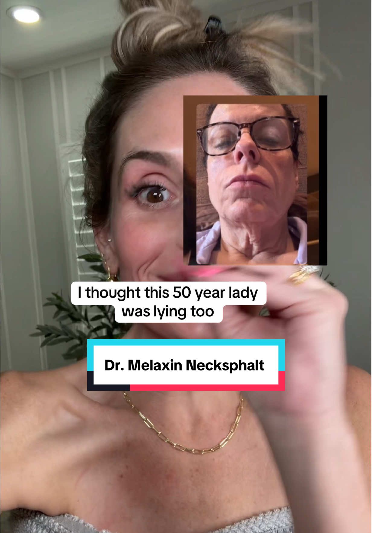 This#necksphalt trio is different from anything else. The micro needling, neck and the serum and cream that has ECM – 5 are clinically proven to thicken the sagging skin and smooth out those fine lines and wrinkles.Results can vary @Dr Melaxin Official #tiktokshopcreatorpicks #tiktokshopblackfriday #antiagingskincare #neckcream 