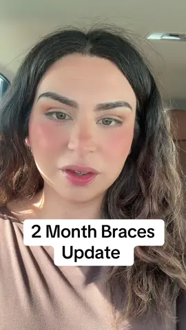 Two months in with braces ✨ Bottom braces are finally on, and I’ll be leveling up with a new wire next month 👏 #progress #bracesjourney #BracesLife #BracesJourney #TwoMonthUpdate       