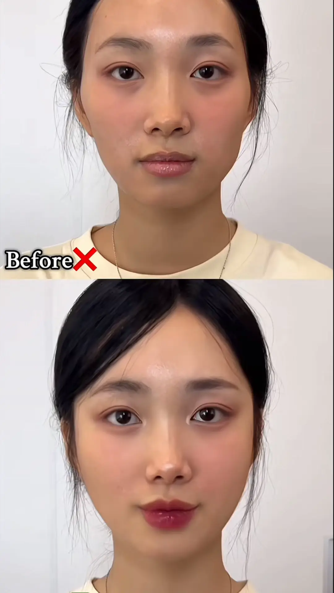 Xinh như tỷ tỷ❤️❤️ #filler #botox #xh 