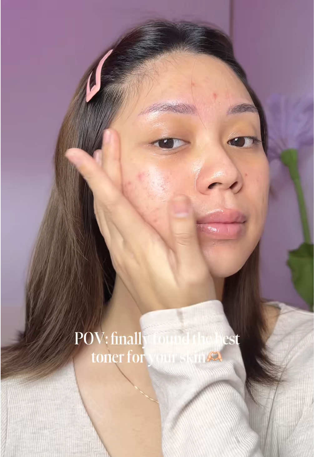This toner tuh literally all in one — hydrating, brightening, plus jaga skin barrier. Anua Rice 70 Glow Milky Toner is such a best investment, must try banget!✨💓 #anuaindonesia #koreanskincare #milkytoner #skincaretok #acneskincare 