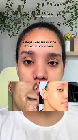The Mighty Bamboo Panthenol Cream is perfect for skin with acne or sensitivity, as it soothes, moisturizes and repairs the skin, helping to reduce redness and breakouts while maintaining a healthy finish. @PURITO SEOUL  #Purito #PanthenolCream #AcneTreatment #RealPostAcneCream #RealPostAcneCreamChallenge