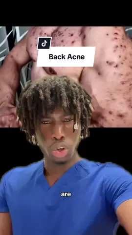 How to Fix Back Acne #GlowUp #acne #backacne #skincare  