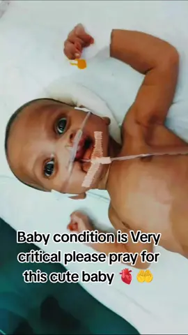 pray for baby condition is Very critical please  #NICU #NICUJourney #pleasegoviral #reposting #NICUWarrior @itxnurse23 @Nurse @🦅NICU BABY🇺🇸 @Haris Axix @@nightangal babycare @nicu_journey 
