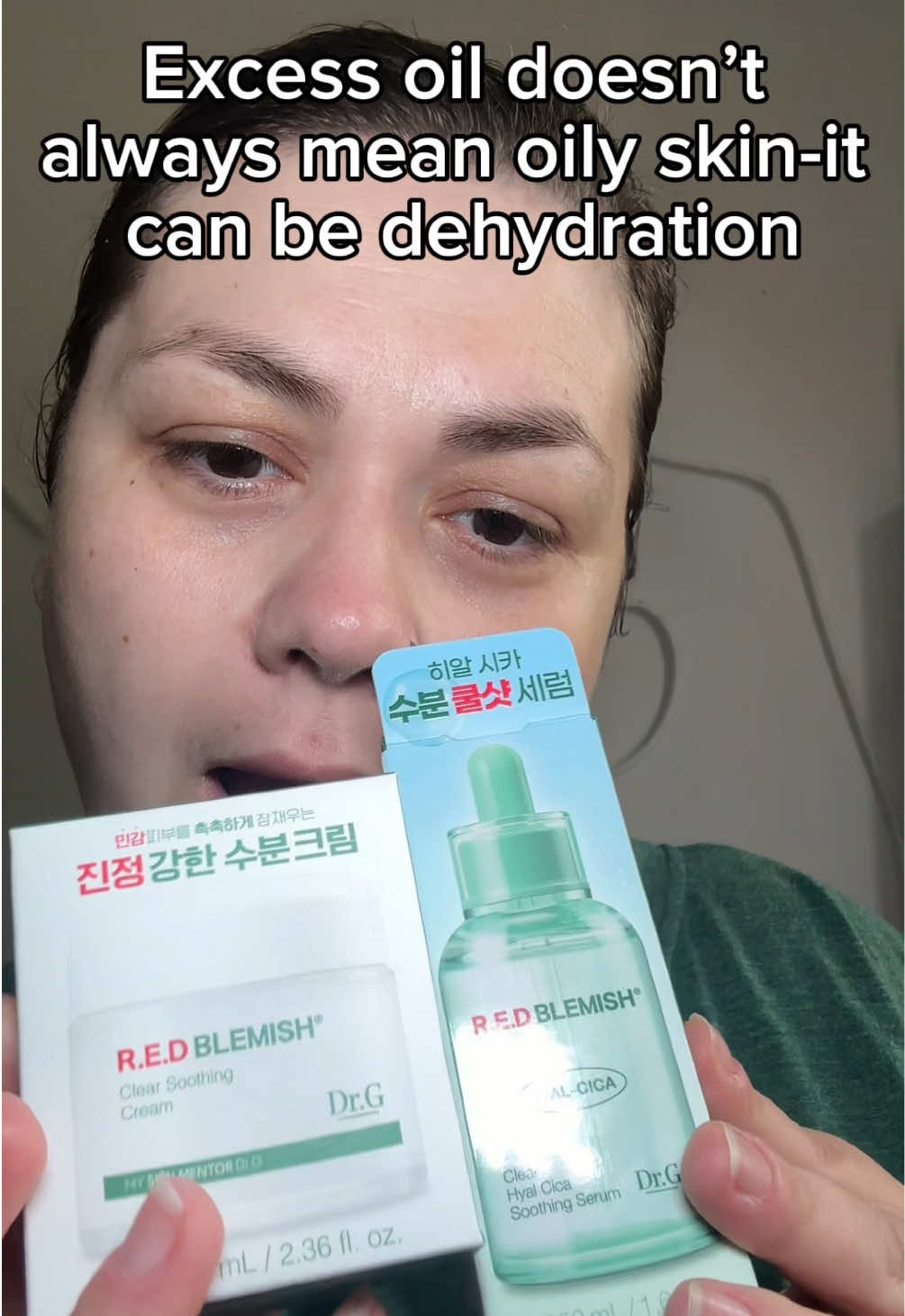 ✨Skincare glow unlocked!✨ I’ve been using the R.E.D Blemish line and my skin is loving it 💚 The Hyal-Cica Serum is super lightweight yet deeply hydrating, calming down redness instantly. Paired with the Clear Soothing Cream, it locks everything in and leaves my skin feeling fresh, soothed, and healthy-looking 🌿✨ If your skin needs hydration + calming care, this combo is a must-try! @Dr. G #drg #SkinCareLover #oilskin #dermatology #REDblemish   @Picky KBeauty 