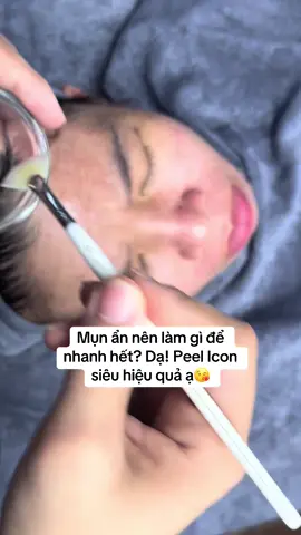 #nặnmunbangtay #ilovetiktok #iconskin 