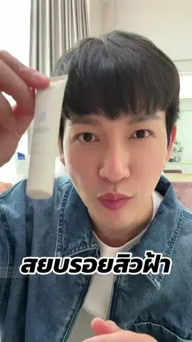ใครเคยเป็นสิวแล้วทิ้งรอย หรือเป็นฝ้า กระ จุดด่างดำ #สกาเจลสมุนไพร จากวิฟสกินเอาอยู่ #วิฟสกิน #vivskin #ครีมจุ๋ย #scargel 