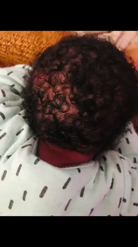 #newbornhair #3monthspostpartum #hairloss #cradlecap 😭😭ow nwele zomntanam  am crying 😢 