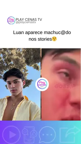 Luan Alencar aparece machuc@Ado em vídeo. Ele está em Paris com seu namorado Caio Cerqueira. #luanalencar #luanecaio #ranchodomaia