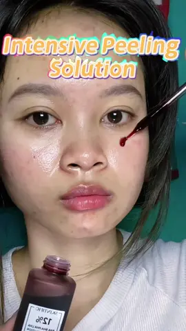 WEST MONTH Intensive Peeling Solution;👏👏#fyp #trending#IntensivePeelingSolution#tiktokgoodfinds