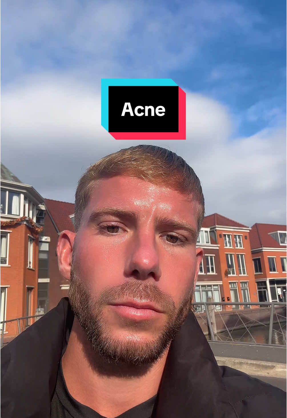 2 minuten. Een product voor al je huidklachten en huidproblemen. #fy #fyp #fitmen #fitgirls #viral #acnefighter #naturalskincare #glowingskin #scarhealing #beeftallow #skincaretips #moisturizer #acneproneskin #acneskincare #wrinkels #antiagingskincare 
