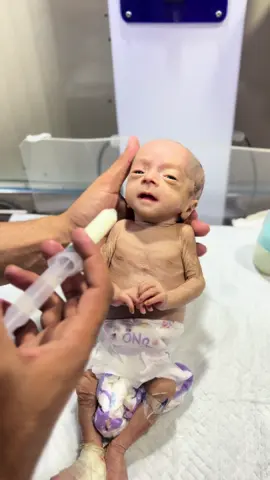 Adorable baby now take feeding very well now please 🙏 #pleasetiktokteam #cute #premature #babby#30milionvewesvirolbaby