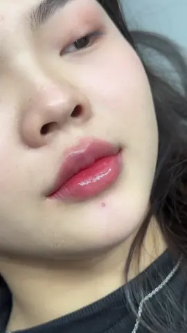 Dáng môi cưng xỉu 💋 #tiemmoidep #moibaby #filler #daotaohocvien 