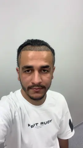 Aynı adam olmak daha zordur…#keşfetteyizzz #fyp #hairtransplant #hairtransplantturkey