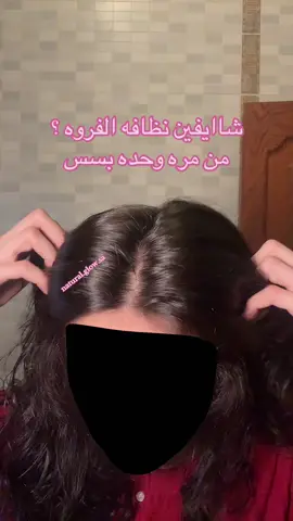 خياالي خيااالي لشعر مقشر الدكتوره هند #عناية_بالشعر #شعر_صحي_لامع #عنايه_اهتمام #تقشير_فروة_الرأس #تقشير_الفروة 