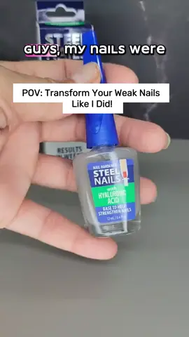 Steel Nails Viral TikTok Nail Hardener 12ml – Hyaluronic Acid, Calcium, Keratin & Garlic Results in Weeks | Tratamiento para Uñas Fuertes y Suaves – Resultados en Semanas #healthynails #nailtechmusthaves #nailtreatment #naturalnailcare #nailtechmusthave #nailsbeauty #manicuregoals #nailreview #nailtechessentials #Nailtok #viralbeauty #tiktokmademebuyit